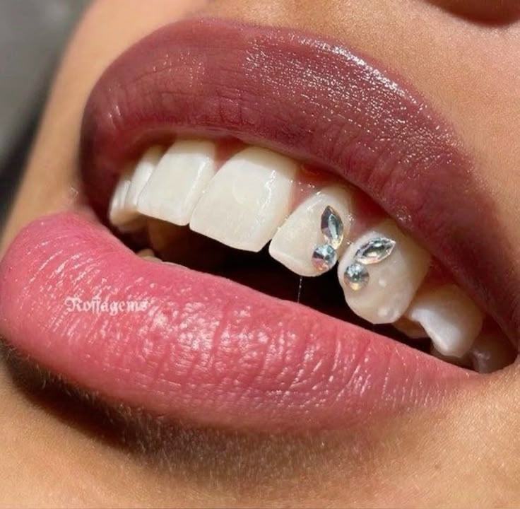 Formation strass dentaire